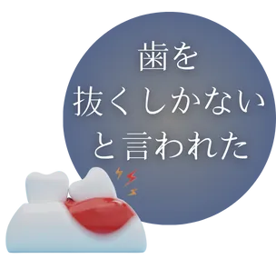 歯を抜くしかないと言われた